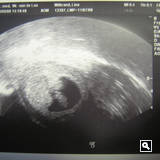 3. Sep '08: 1. Ultraschall (8. SW)
